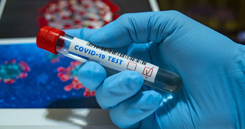 El precio de la prueba de coronavirus en Nicaragua es de 150 dólares. Imagen de referencia.