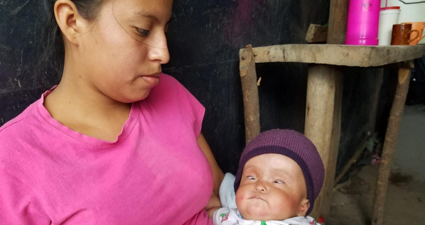 La niña será operada en Managua pero su familia necesita ayuda con algunos gastos. Foto: Denis García