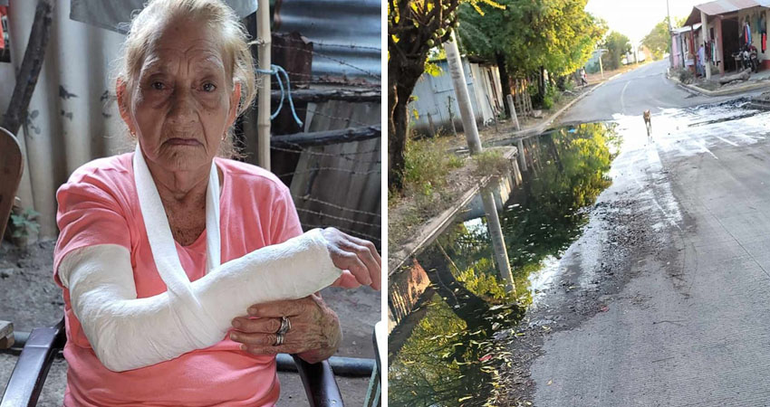 Juana Jirón de 78 años sufrió una fractura. Foto: Cortesía/Radio ABC Stereo