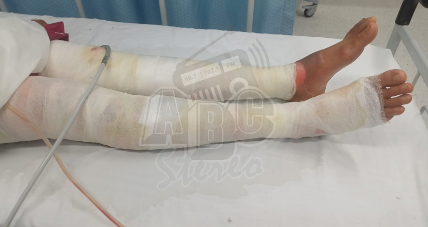 El accidente ocurrió en la comunidad San Jerónimo, Murra. Foto: Cortesía/Radio ABC Stereo