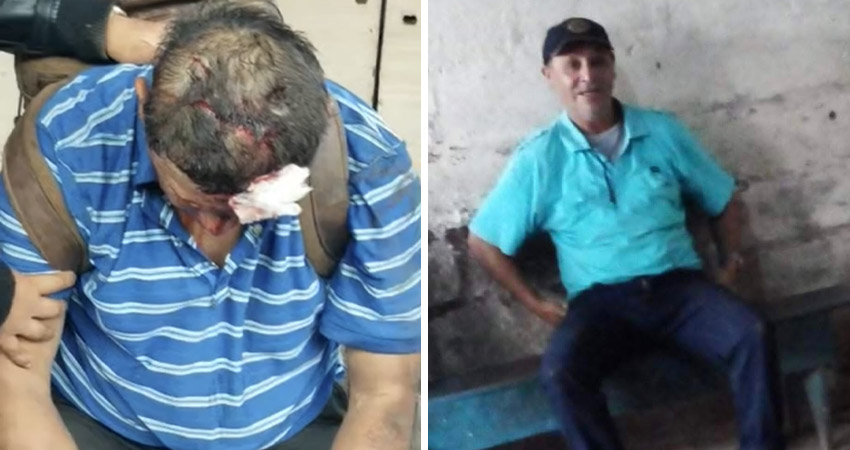 Pobladores auxiliaron a la víctima, pero los golpes recibidos fueron mortales. Foto: Cortesía/Radio ABC Stereo
