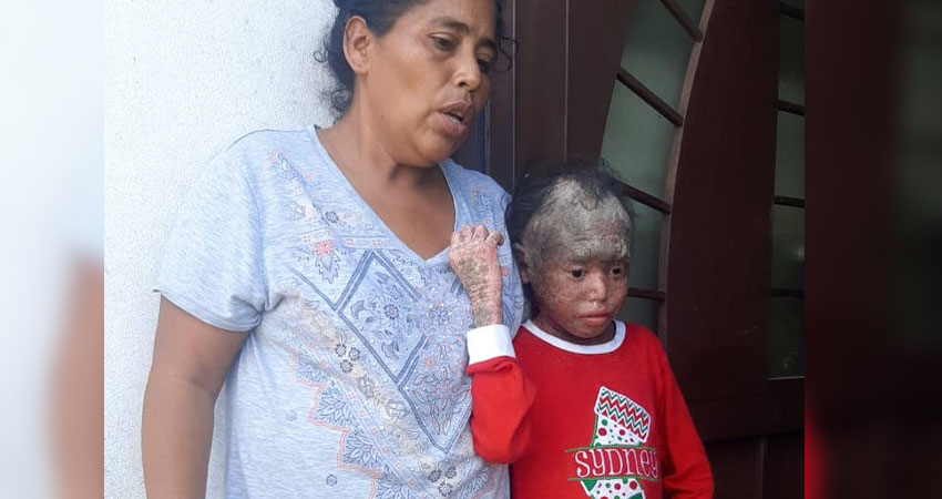 La niña requiere alimentos, vaselina y jarabes. Foto: Famnuel Úbeda/Radio ABC Stereo