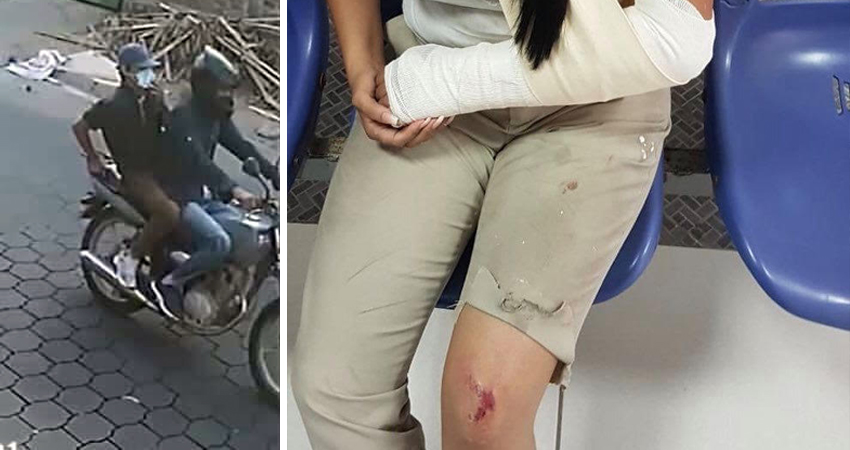 La joven Cristina Vindell sufrió un fractura y lesiones tras el intento de robo. Foto: Cortesía