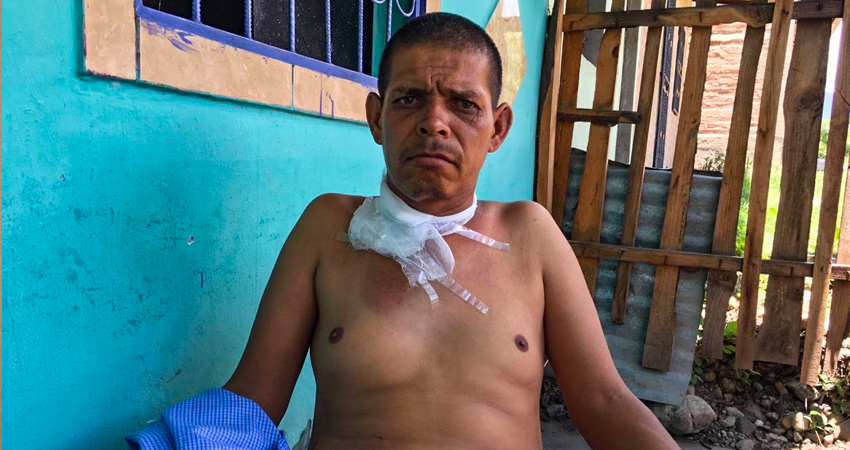 Alexander Arauz Herrera fue agredido el sábado pasado. Foto: Alba Nubia Lira/Radio ABC Stereo
