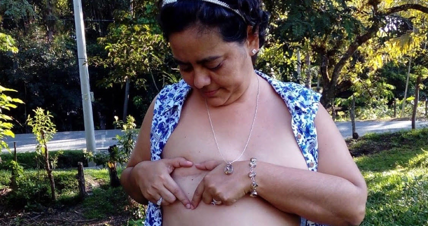 Timotea del Carmen Marín Rivera logró sobrevivir al cáncer de mama y orgullosa muestra la cicatriz que la hace vencedora de la batalla. Foto: José Enrique Ortega/Radio ABC Stereo