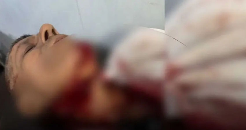 El señor fue remitido al hospital regional de Matagalpa por su estado delicado. Foto: Cortesía/Radio ABC Stereo