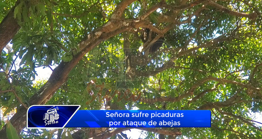 Señora sufre picaduras por ataque de abejas