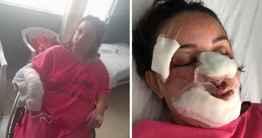 Julissa tiene 19 años de edad. La agresión ocurrió en diciembre, pero le recepcionaron la denuncia hasta que salió del hospital. Foto: Cortesía/Radio ABC Stereo
