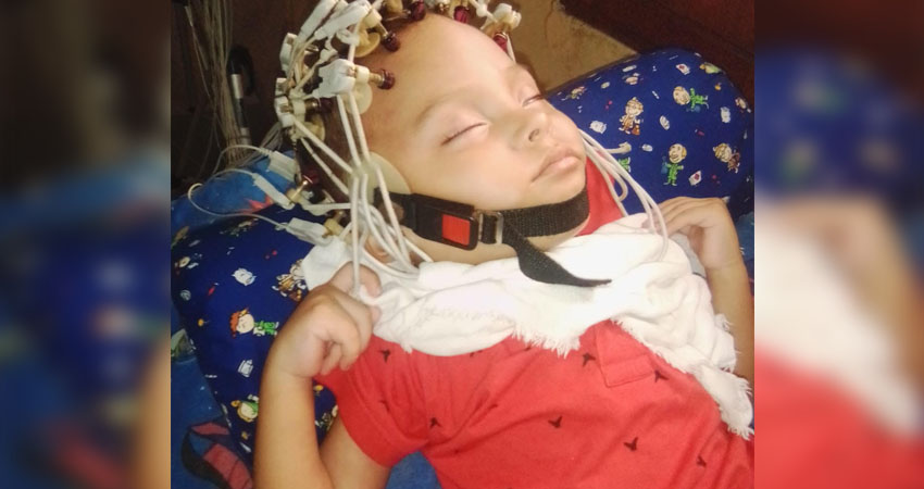 Paciente infantil con hidrocefalia. Foto: Cortesía/Radio ABC Stereo