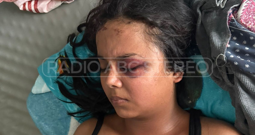 El sujeto le causó una lesión ocular de consideración a la víctima. Foto: Cortesía/Radio ABC Stereo