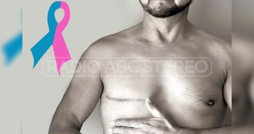 El cáncer de mama también puede afectar a hombre.   Foto: Imagen de referencia / Radio ABC Stereo