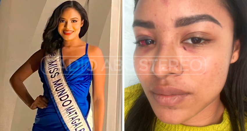 Una de las víctimas fue la representante de Miss Mundo Matagalpa en 2021. Foto: Cortesía/Radio ABC Stereo