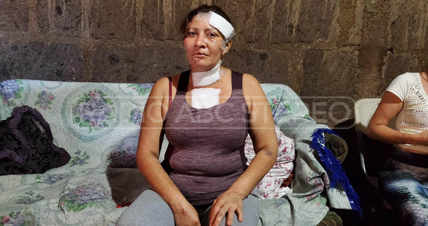 Los médicos dudaban que Rosa Hernández sobreviviera. Foto: José Enrique Ortega/Radio ABC Stereo