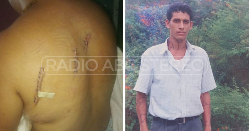 La víctima fue atacada presuntamente por su ex pareja, José Francisco Aguirre Mendoza. Foto: Cortesía/Radio ABC Stereo