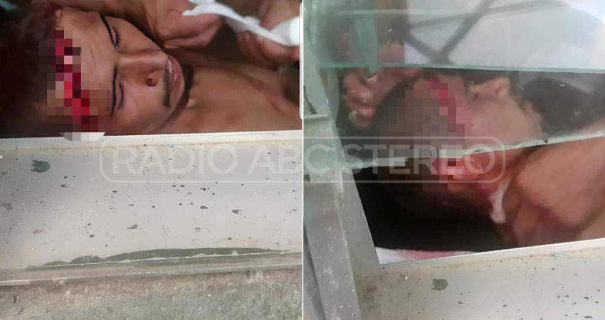 Esta es la segunda vez en que es atacado. Foto: Cortesía/Radio ABC Stereo